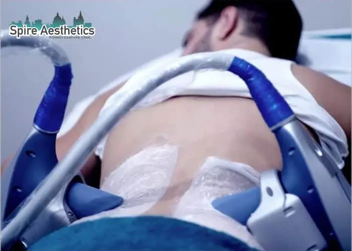 Man having fat freezing treatment done on love handles before a competitions Whitley Sands to create a sculpted look.